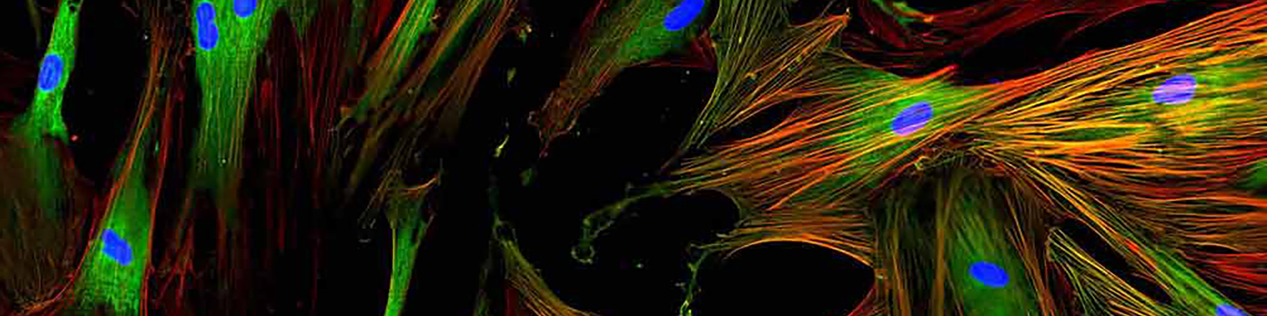 Micrograph of human umbilical-cord mesenchymal stem cells
