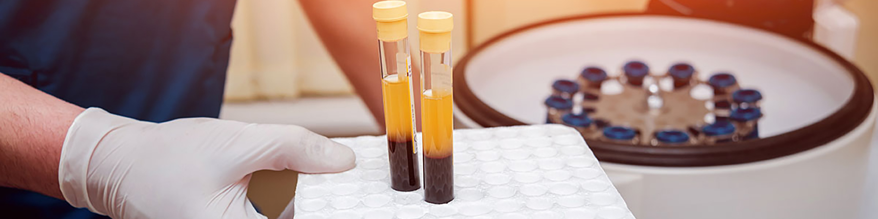 Clinician performing a platelet-rich plasma (PRP) injection procedure