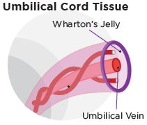 Diagram of MSC sources: Wharton's Jelly and cord blood from the umbilical cord