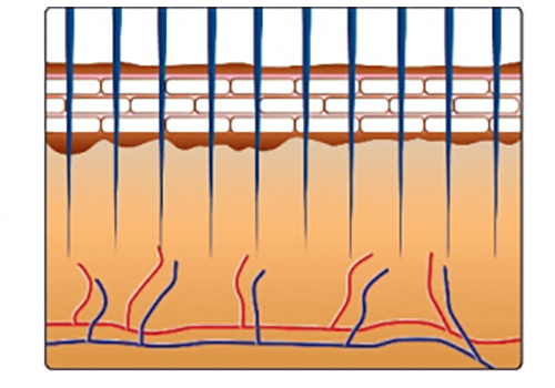 Microneedling